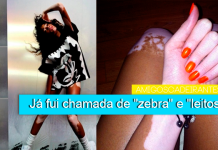 “Eu poderia tirar toda a pele marrom e ser apenas branca.”